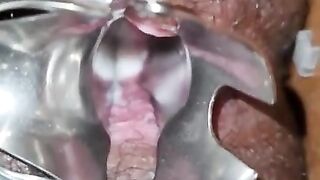 Sri Lanka Girl Experiencing Pussy Vaginal Expansing Toy