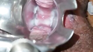 Sri Lanka Girl Experiencing Pussy Vaginal Expansing Toy