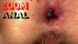 POV Creampie Anal - Big Cum inside Tight Asshole - ARAB ANAL