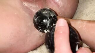 My Sexy Husband taking Anal Beads the Size of Tennis Balls!!