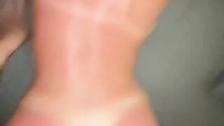 Sunburnt Slut Fucked Raw and Creampied