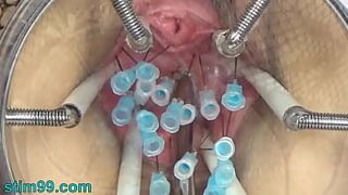 Extreme German BDSM Needles inner Pussy Cervix and Tits