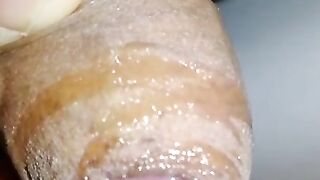 Uncircumcised Hard Cock Plays with Foreskin and Pre-cum Close-up, Hard Micropenis