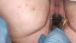 Wife Ashley's gyno exam with Dr Johnny