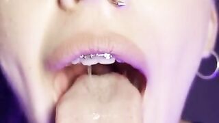 Gag reflex. Drooling and gagging by metal mouth